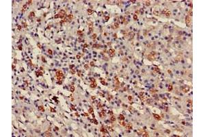 Immunohistochemistry of paraffin-embedded human adrenal gland tissue using ABIN7175158 at dilution of 1:100 (USP6NL 抗体  (N-Term))