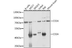 Western blot analysis of extracts of various cell lines, using CD24 antibody (ABIN1512696, ABIN3023213, ABIN3023214 and ABIN6219443) at 1:1000 dilution. (CD24 抗体  (AA 1-80))