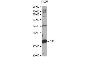Western blot analysis of extracts of HL-60 cells, using BID Antibody (ABIN1871288). (BID 抗体)
