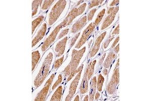 C staining MFN2 in human heart tissue sections by Immunohistochemistry (IHC-P - paraformaldehyde-fixed, paraffin-embedded sections). (MFN2 抗体  (AA 447-476))