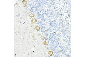 Immunohistochemistry of paraffin-embedded rat cerebellum using RPL10A Rabbit pAb (ABIN6129099, ABIN6147103, ABIN6147104 and ABIN6221624) at dilution of 1:100 (40x lens). (RPL10A 抗体  (AA 1-110))