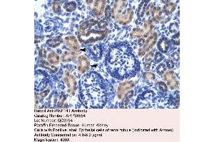Human kidney (RNF141 抗体  (Middle Region))