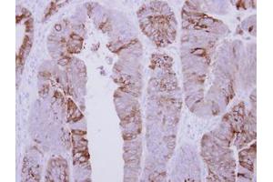 Image no. 1 for anti-AChE Q Subunit (COLQ) (AA 248-455) antibody (ABIN1497560) (COLQ 抗体  (AA 248-455))