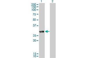 Western Blot analysis of MGC40579 expression in transfected 293T cell line by MGC40579 monoclonal antibody (M11), clone 2C11. (GK5 抗体  (AA 1-89))