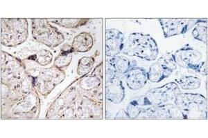 Immunohistochemistry analysis of paraffin-embedded human placenta tissue, using PHCA Antibody. (ACER3 抗体  (AA 171-220))