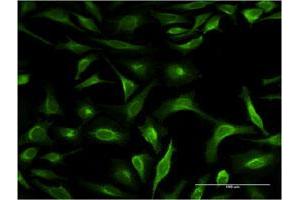 Immunofluorescence of monoclonal antibody to S100P on HeLa cell.