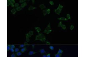 Immunofluorescence analysis of HeLa cells using SS18L1 Polyclonal Antibody at dilution of 1:100. (SS18L1 抗体)