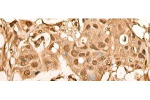 Immunohistochemistry (Paraffin-embedded Sections) (IHC (p)) image for anti-BRF2, Subunit of RNA Polymerase III Transcription Initiation Factor, BRF1-Like (BRF2) antibody (ABIN7246043)