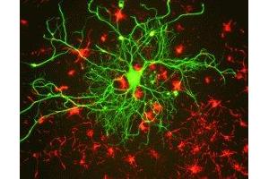 Immunostaining of cultured rat neurons with anti-mouse neurofilament L (green) and anti-rabbit alpha internexin. (NEFL 抗体)