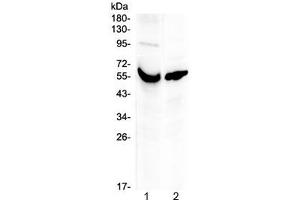Western blot testing of human 1) placenta and 2) A431 lysate with VDBP antibody at 0. (Vitamin D-Binding Protein 抗体)
