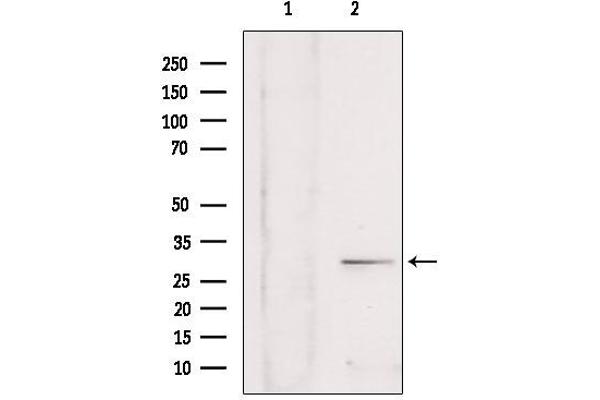 SULT4A1 抗体  (C-Term)