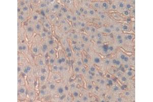 IHC-P analysis of Mouse Tissue, with DAB staining. (IL-6 Receptor 抗体  (AA 205-347))