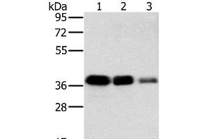Western Blot analysis of A549, HT-29 and A172 cell using MTFR1 Polyclonal Antibody at dilution of 1:500 (MTFR1 抗体)