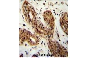 C Antibody (N-term) (ABIN655004 and ABIN2844639) immunohistochemistry analysis in formalin fixed and paraffin embedded human breast tissue followed by peroxidase conjugation of the secondary antibody and DAB staining. (CI150 抗体  (N-Term))