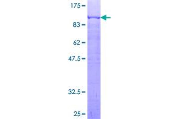 PRC1 Protein (AA 1-620) (GST tag)