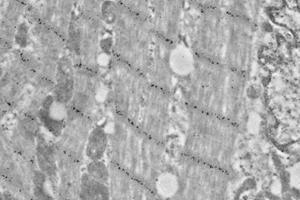 Immunoelectron microscopy analysis of LR white resin-embedded mouse heart using alpha Actinin 2 (ABIN7075510) at dilution of 1: 50. (Sarcomeric alpha Actinin 抗体)