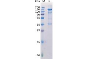 Human PMEL Protein, hFc Tag on SDS-PAGE under reducing condition. (Melanoma gp100 Protein (Fc Tag))