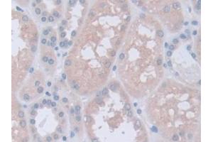 DAB staining on IHC-P; Samples: Human Kidney Tissue (Inversin 抗体  (AA 1-237))