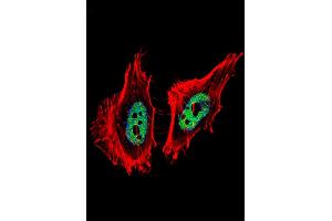 Fluorescent confocal image of Hela cell stained with CTBP1 Antibody . (CTBP1 抗体  (C-Term))