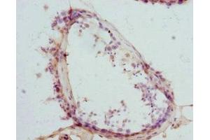 Immunohistochemistry of paraffin-embedded human testis tissue using ABIN7145457 at dilution of 1:100 (CTNNBL1 抗体  (AA 264-563))