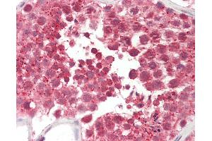 Anti-CILD9 / DNAI2 antibody IHC staining of human testis. (DNAI2 抗体  (AA 71-120))