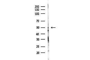 Western blot analysis of lysates from Rat testis, using KCNJ8 Antibody at 1/1000 dilution.