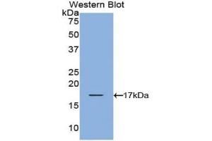 Western blot analysis of the recombinant protein. (TCL1A 抗体  (AA 1-114))