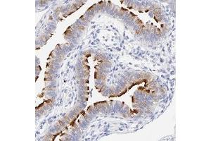 Immunohistochemical staining of human fallopian tube with WDR65 polyclonal antibody ( Cat # PAB27990 ) shows strong membranous positivity in glandular cells at 1:50 - 1:200 dilution. (WDR65 抗体)