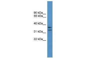 Western Blot showing SCAMP3 antibody used at a concentration of 1-2 ug/ml to detect its target protein. (SCAMP3 抗体  (N-Term))