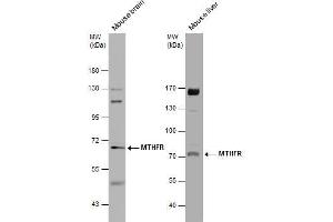 WB Image Various tissue extracts (50 μg) were separated by 7. (MTHFR 抗体)
