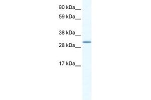 WB Suggested Anti-SPIC Antibody Titration:  1. (SPIC 抗体  (N-Term))