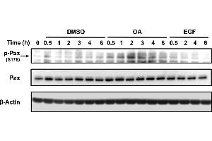 Total protein extracts from serum-starved sub-confluent MDA-MB 231 cells treated with 10 um OA, EGF or DSMO equivalent volume as vehicle control.