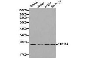 Western Blotting (WB) image for anti-RAB11A, Member RAS Oncogene Family (RAB11A) antibody (ABIN1874497) (RAB11A 抗体)