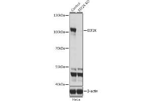 Western blot analysis of extracts from normal (control) and EEF2K knockout (KO) HeLa cells, using EEF2K antibody (ABIN6130354, ABIN6139955, ABIN6139956 and ABIN7101771) at 1:1000 dilution. (EEF2K 抗体  (AA 406-725))