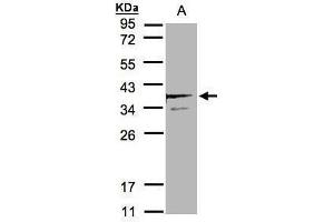 WB Image Sample(30 μg of whole cell lysate) A:MOLT4, 12% SDS PAGE antibody diluted at 1:2000 (SCAMP3 抗体)