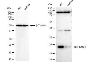 Western blotting analysis using NME1 antibody (ABIN7799616).