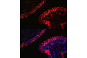 Immunofluorescence (IF) image for anti-Keratin 16 (KRT16) (AA 190-430) antibody (ABIN6143021)