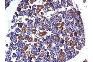 Formalin-fixed and paraffin embedded: rat submaxillary gland labeled with Anti-ER-alpha Polyclonal Antibody (ABIN725300), Unconjugated at 1:200 followed by conjugation to the secondary antibody and DAB staining (Estrogen Receptor alpha 抗体  (AA 331-360))