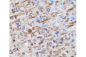 Immunohistochemistry of paraffin-embedded Rat brain using MAP1LC3A Polyclonal Antibody at dilution of 1:100 (40x lens). (MAP1LC3A 抗体)