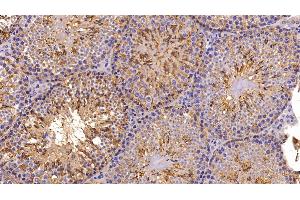 Immunohistochemistry (IHC) image for anti-Nucleoside diphosphate kinase B (NME2) (AA 8-149) antibody (ABIN7439627)
