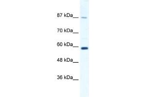 WB Suggested Anti-KIF23 Antibody Titration:  1. (KIF23 抗体  (N-Term))