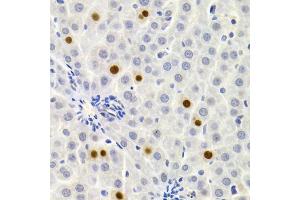 Immunohistochemistry of paraffin-embedded rat liver using GEMIN2 Antibody (ABIN1872798) at dilution of 1:200 (40x lens). (SIP1 抗体)