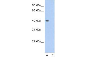 Host:  Rabbit  Target Name:  PCBP1  Sample Type:  HepG2  Lane A:  Primary Antibody  Lane B:  Primary Antibody + Blocking Peptide  Primary Antibody Concentration:  2. (PCBP1 抗体  (Middle Region))