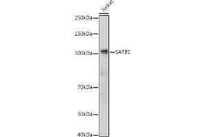 Western blot analysis of extracts of Jurkat cells, using S antibody (ABIN6130296, ABIN6147396, ABIN6147398 and ABIN6221485) at 1:1000 dilution. (SATB1 抗体  (AA 484-763))