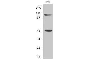 Western Blotting (WB) image for anti-Nuclear Factor of kappa Light Polypeptide Gene Enhancer in B-Cells 1 (NFKB1) (Thr157) antibody (ABIN6282773)