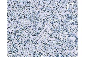 IHC analysis of splicing factor 1 using anti-splicing factor 1 antibody (ABIN7600193). (Splicing Factor 1 抗体  (AA 160-266))