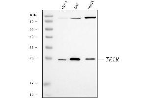 Western blot analysis of TRIR using anti-TRIR antibody (ABIN7603244). (Uncharacterized Protein C19orf43 (TRIR) (N-Term) 抗体)
