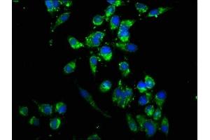 Immunofluorescence staining of Hela cells with ABIN7174460 at 1:166, counter-stained with DAPI. (UBE2K 抗体  (AA 2-200))