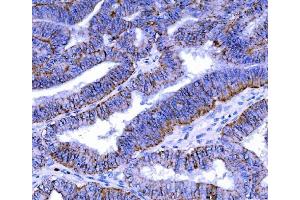 IHC analysis of Claudin 7/CLDN-7 using anti-Claudin 7/CLDN-7 antibody (ABIN7602665). (Claudin 7 抗体  (AA 92-211))