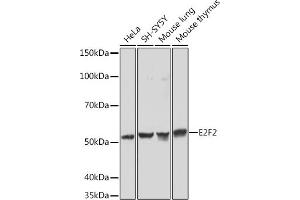 Western blot analysis of extracts of various cell lines, using E2F2 Rabbit mAb (ABIN1680064, ABIN3017656, ABIN3017657 and ABIN7101516) at 1:1000 dilution. (E2F2 抗体)